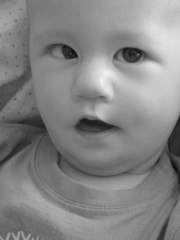 Hipopituitarizm Belirtileri ve Tedavisi Hipopituitarizm Belirtileri ve Tedavisi